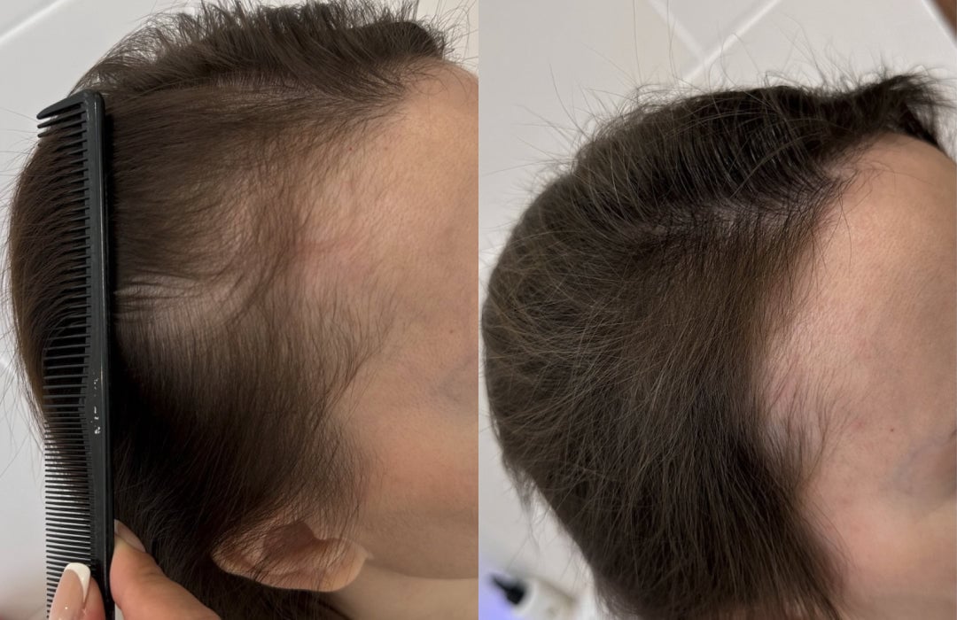 3-in-1 Hair Regrowth Comb