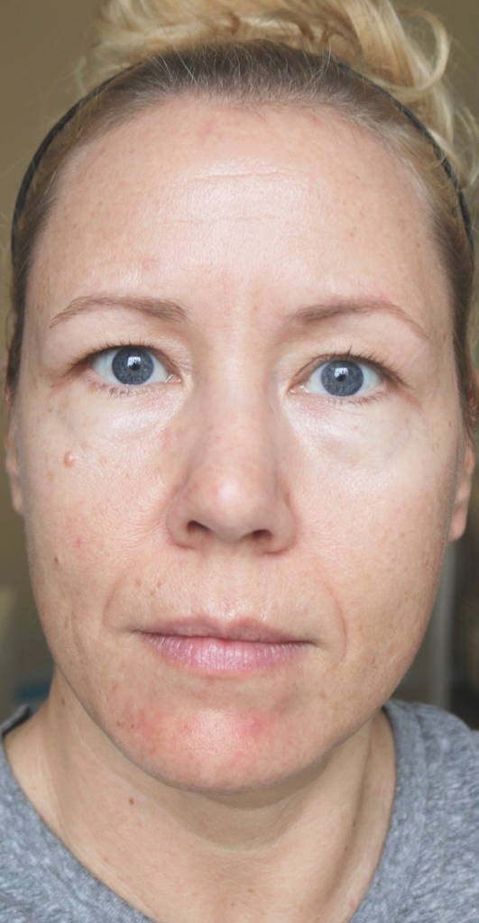 Omni™ - Led Microcurrent Handset (3 In 1)