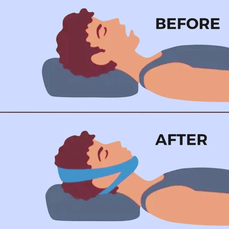 Snormed™ Jaw Strap