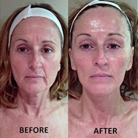 Omni™ - Led Microcurrent Handset (3 In 1)