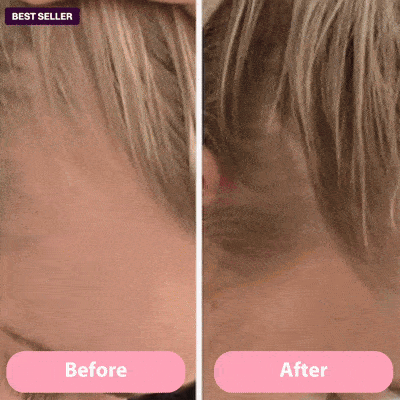 3-in-1 Scalp Massaging Red Light Therapy Brush