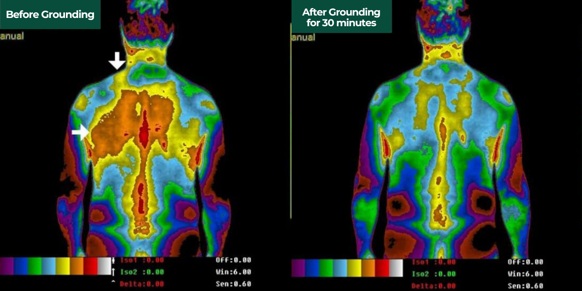 Healthygrounding® - Bed Sheet