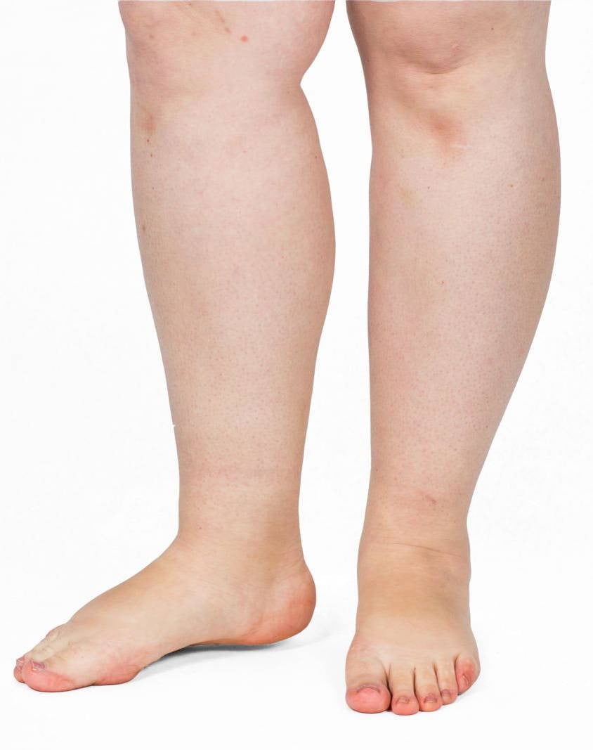 Legslims® Compression Leggings