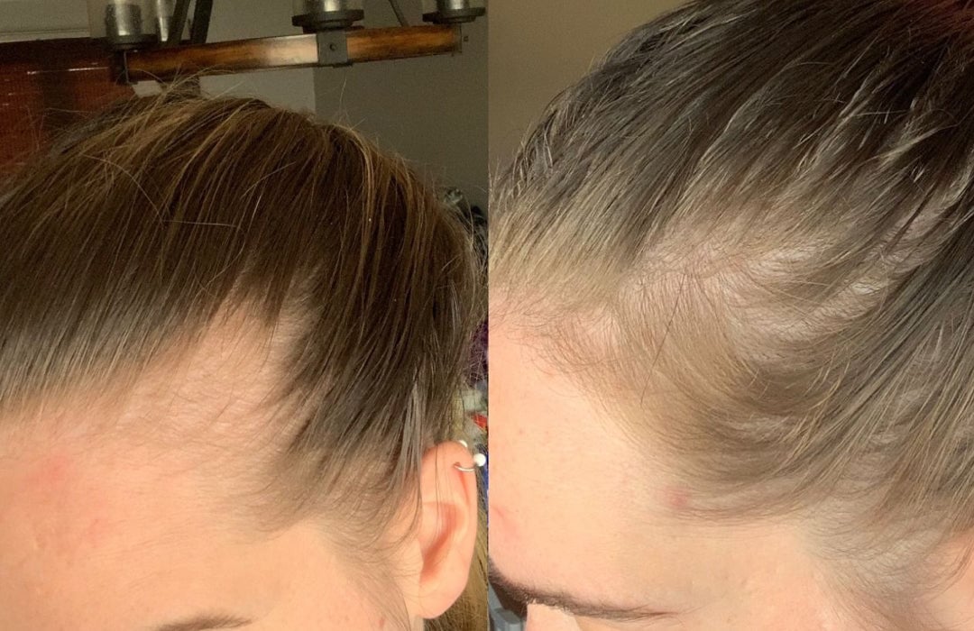 3-in-1 Hair Regrowth Comb