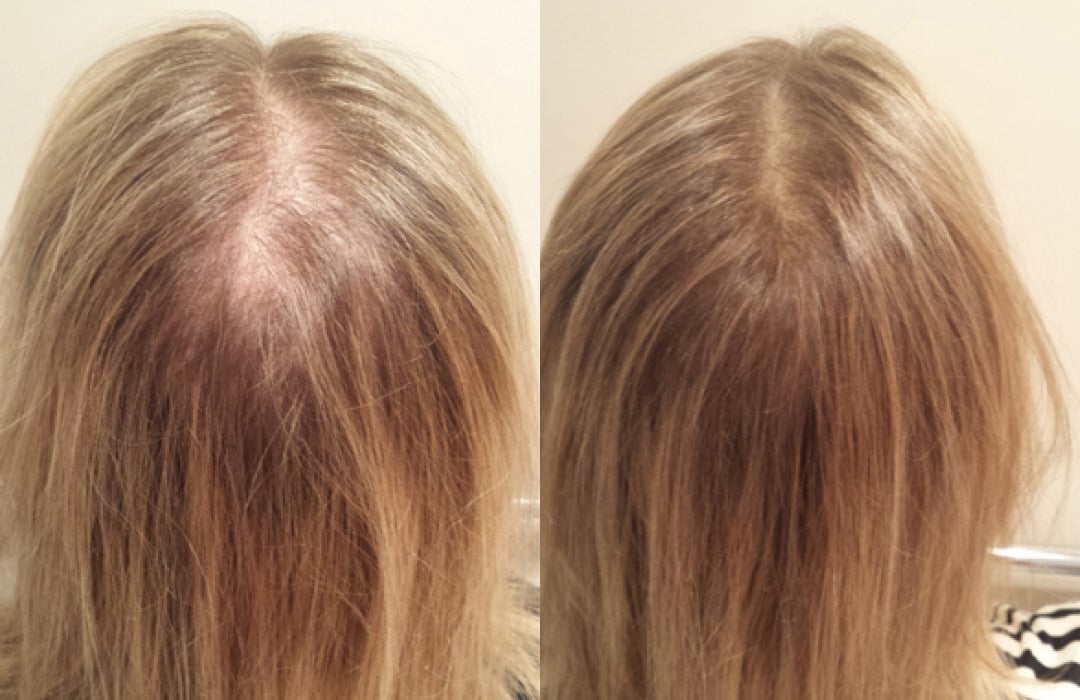 3-in-1 Hair Regrowth Comb