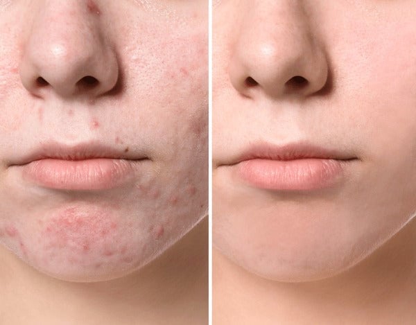 Ultrasonic Skin Scrubber™