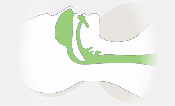 Tranquility Pro 2.0 Anti-snoring Mouth Guard 