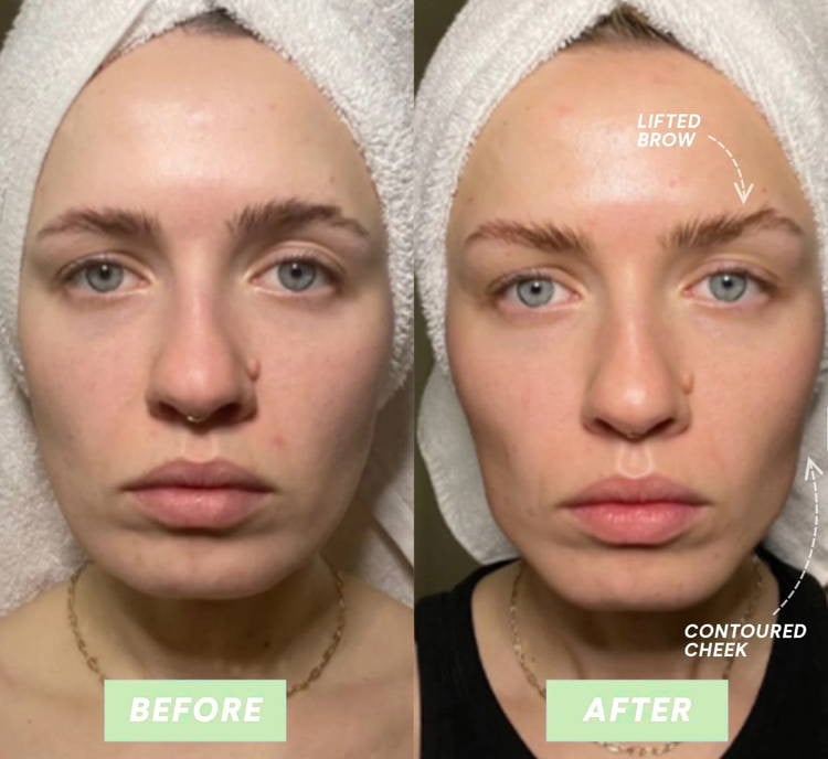 Omni™ - Led Microcurrent Handset (3 In 1)