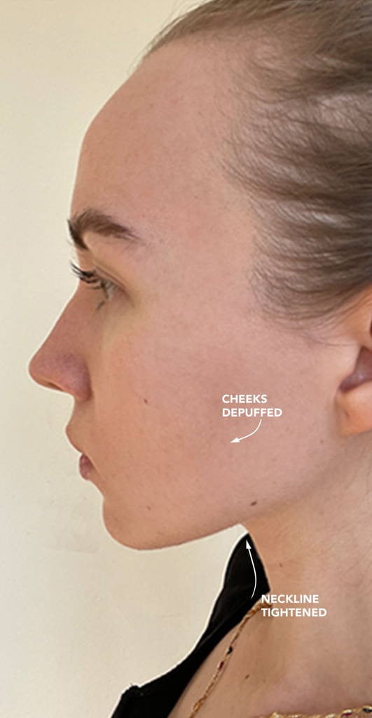 Omni™ - Led Microcurrent Handset (3 In 1)