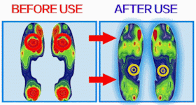 Nanccy Plus Size Wide Diabetic Shoes For Swollen Feet Width Shoes-wd017