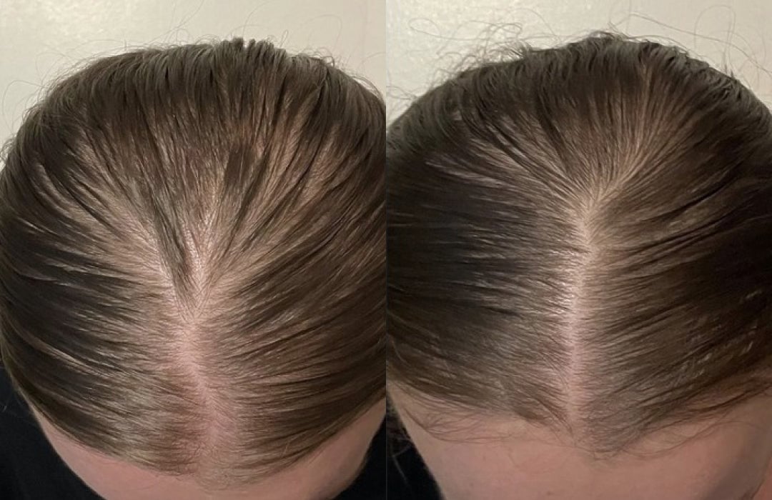 3-in-1 Hair Regrowth Comb