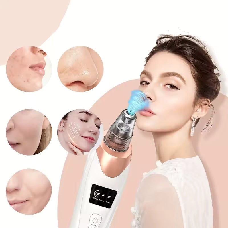 Blackhead Pore Removing Vacuum - 4fit