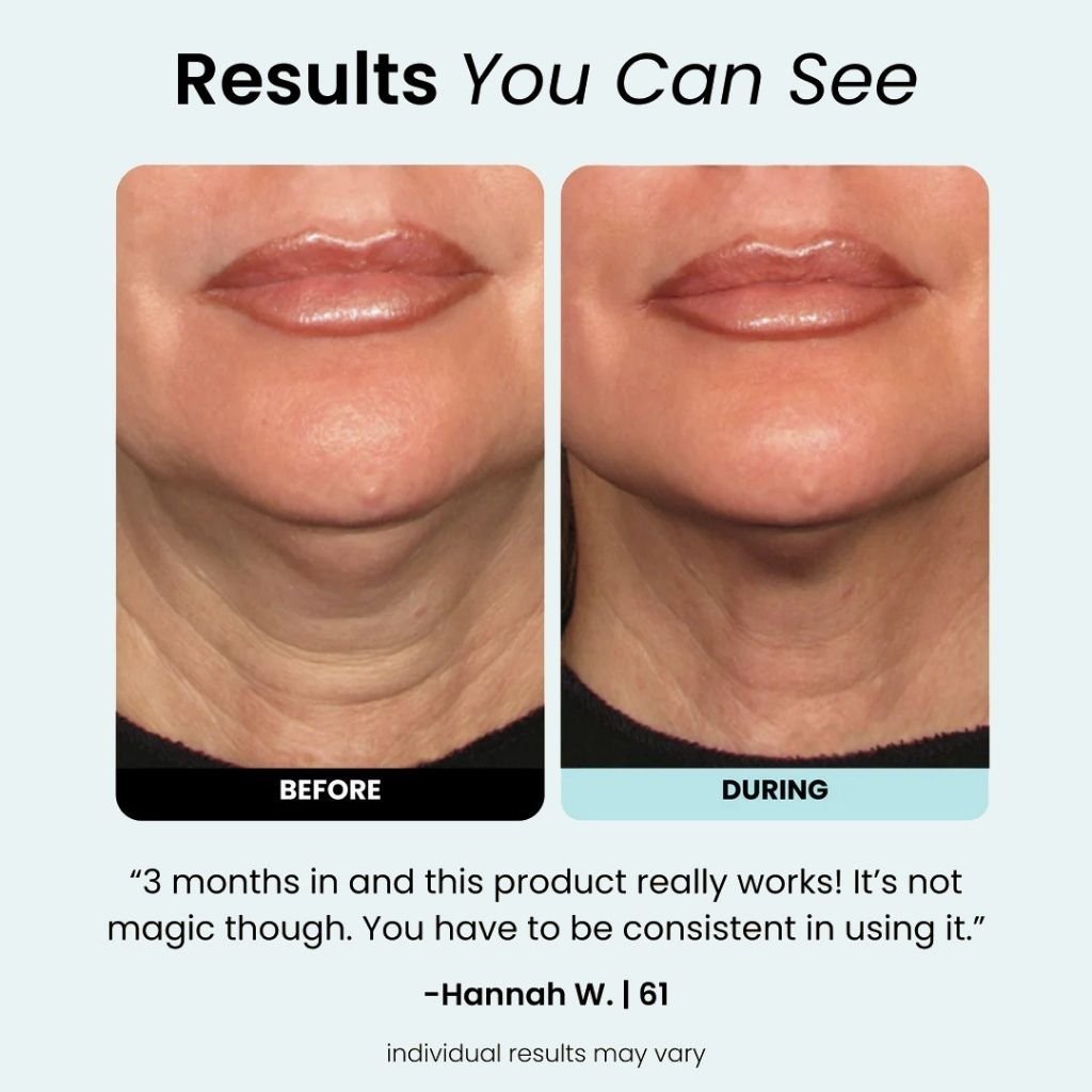 Lumidermis™ - Regenmask - Aflorest