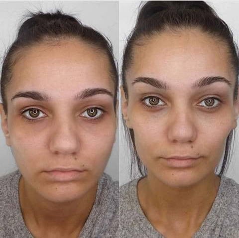 Omni™ - Led Microcurrent Handset (3 In 1)