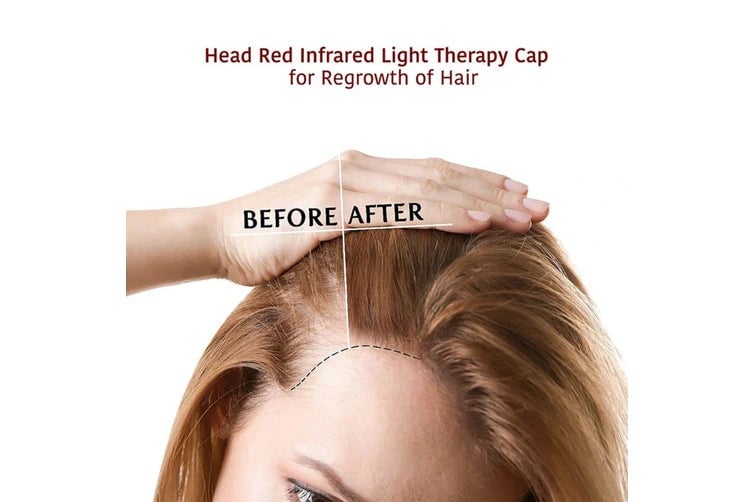Red Light Therapy Cap - Skinovate