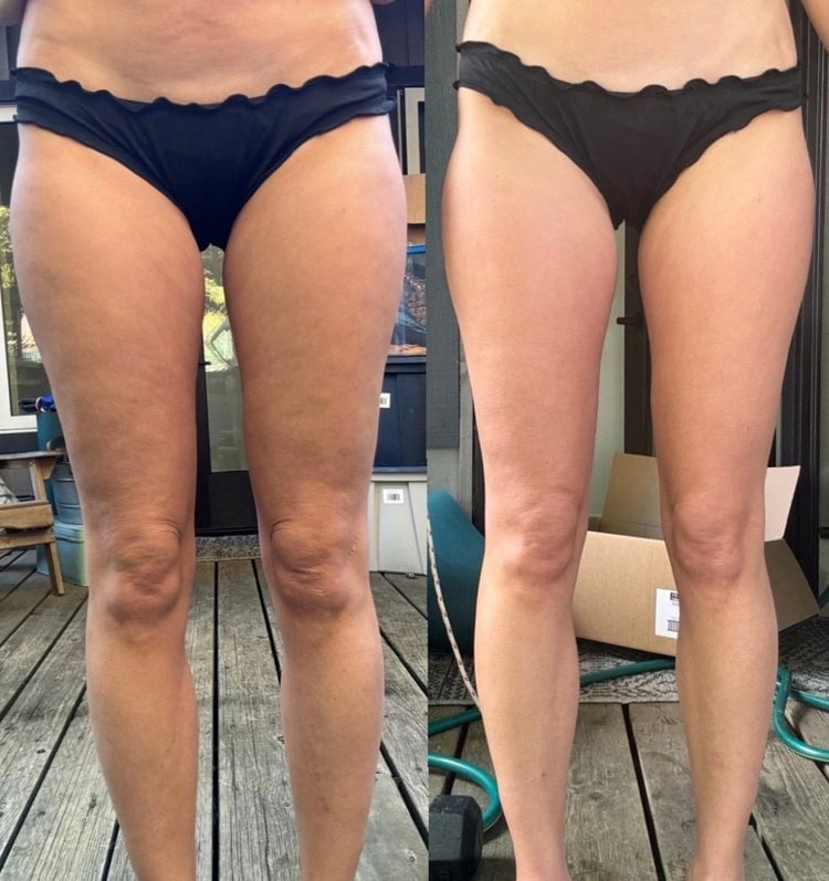 Anti-cellulite | Firm & Tone Tool - Elouris
