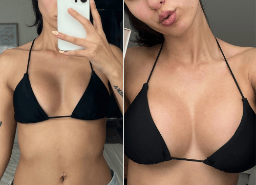 Evervia™ - Boost Sticky Inserts