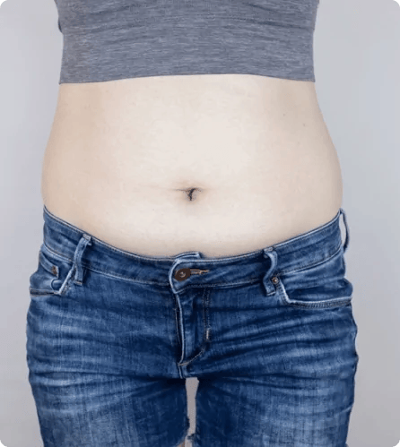 Waist Trainer - Waistora