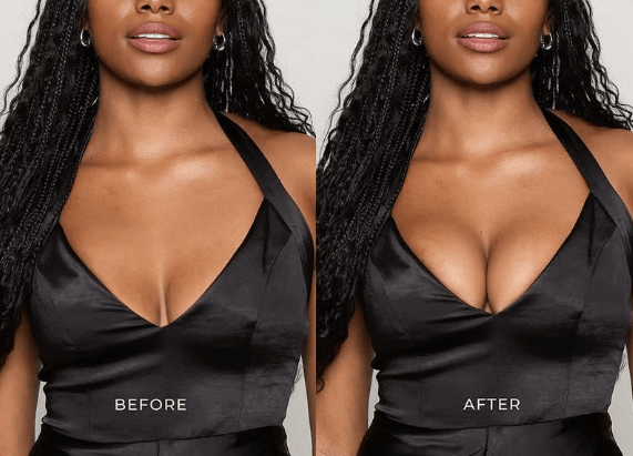 Evervia™ - Boost Sticky Inserts