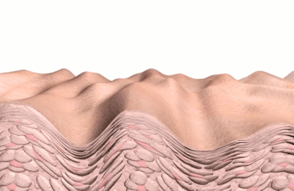 Mediderm Skin – Lyftr Face Sculptor