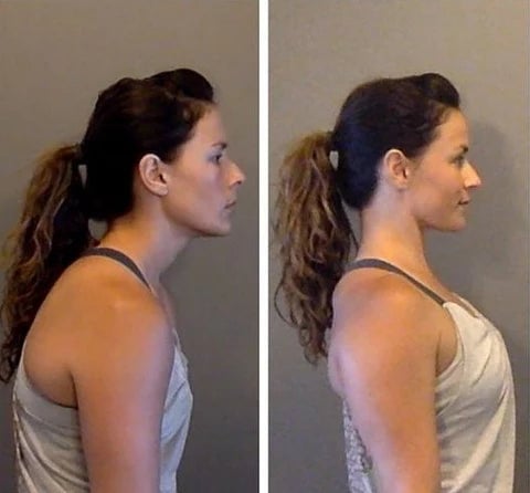 Posturepro™ Premium Posture Corrector - Luxuriana