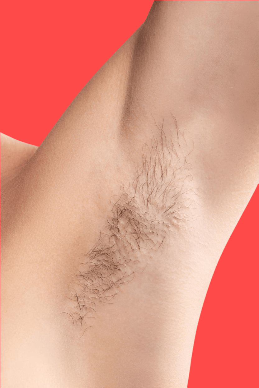 Valtisa™ Ipl Beauty Light