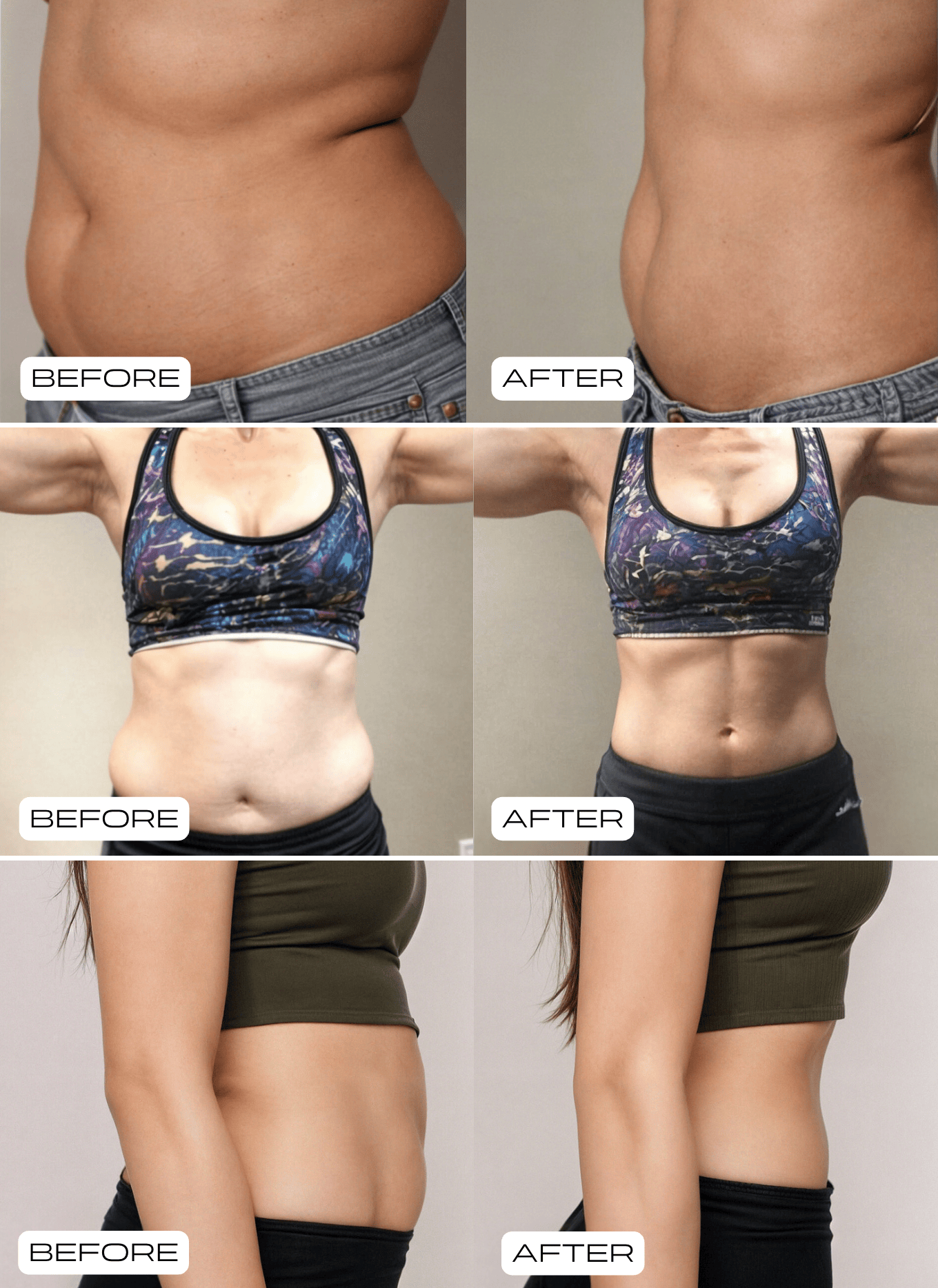 Pilates Reformer Set