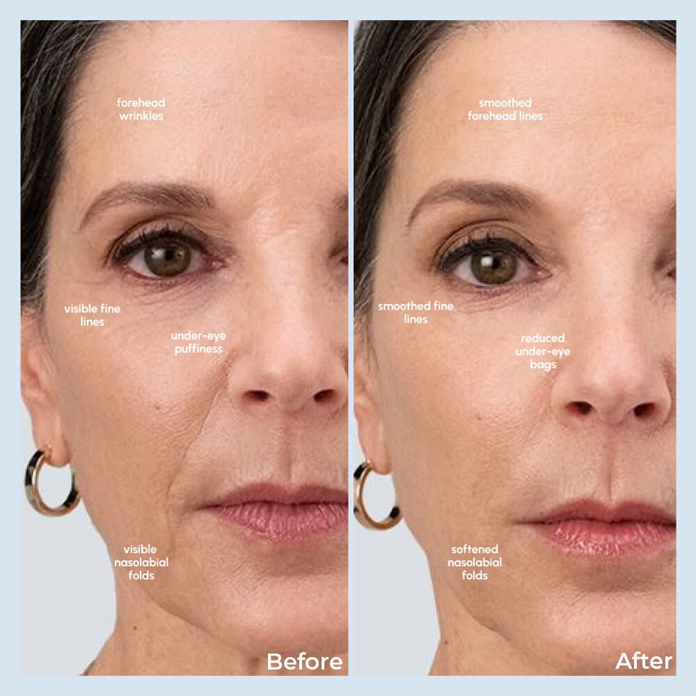 Glidelif Multi-sculpt Wand