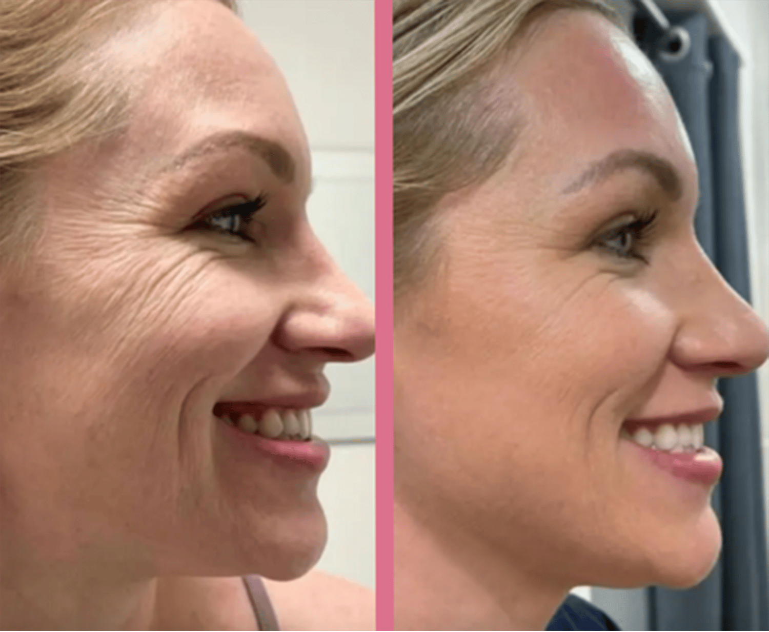 Glowie™ | Facial Enhancement Handset