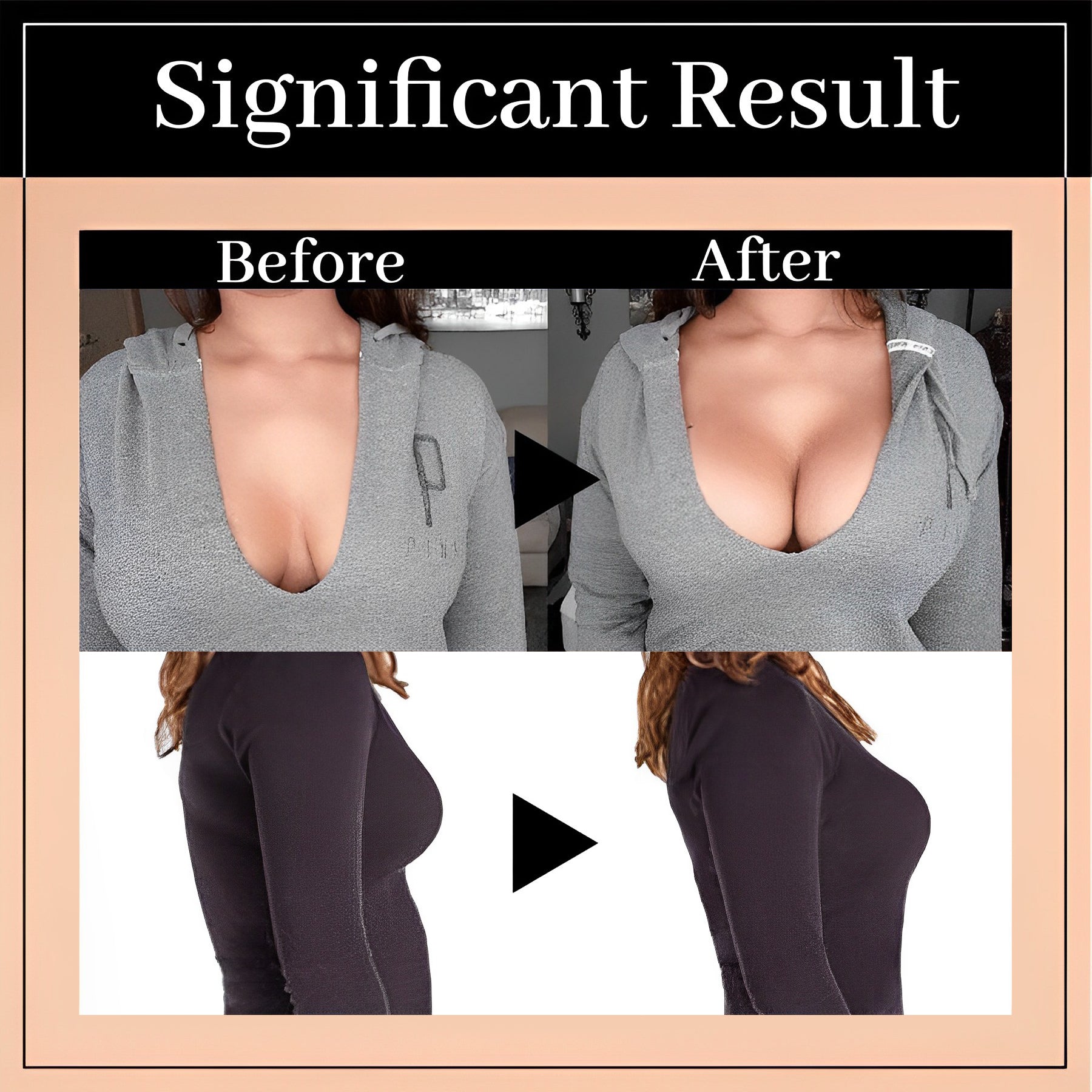 Helen Bra - Front Closure Posture Wireless Back Support Full Coverage Bra (Buy 1 Get 2 Free)-beige+white+black