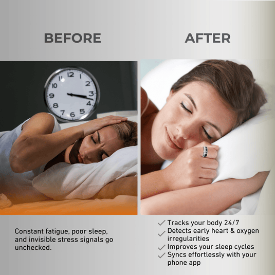 Aglluux Next-gen Ring - Agllux