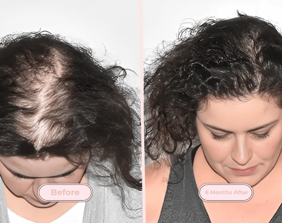 Red Light Therapy Scalp Massager