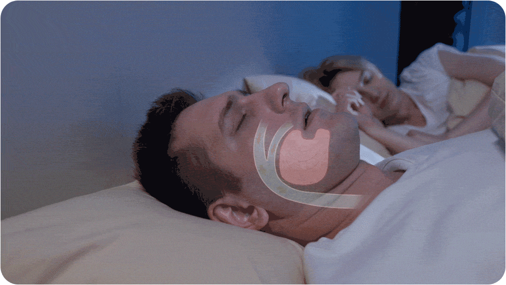 Hoseless, Maskless, Micro-cpap Anti Snoring