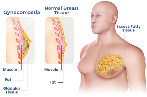 🔥2023 New Version Ionic Shaping Sleeveless Shirt