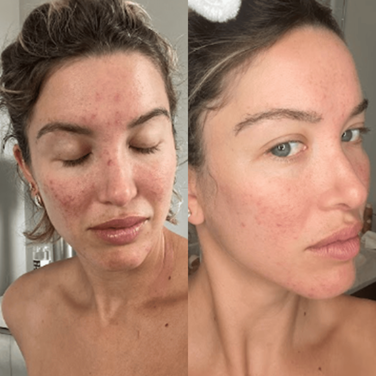 7-in-1 Led Facial Sculptor