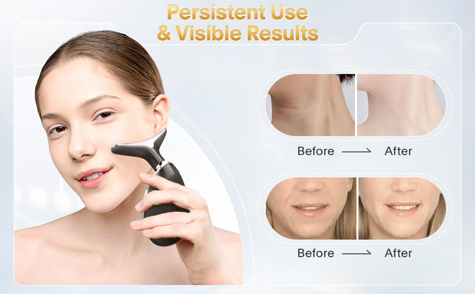 Glowie™ | Facial Enhancement Handset